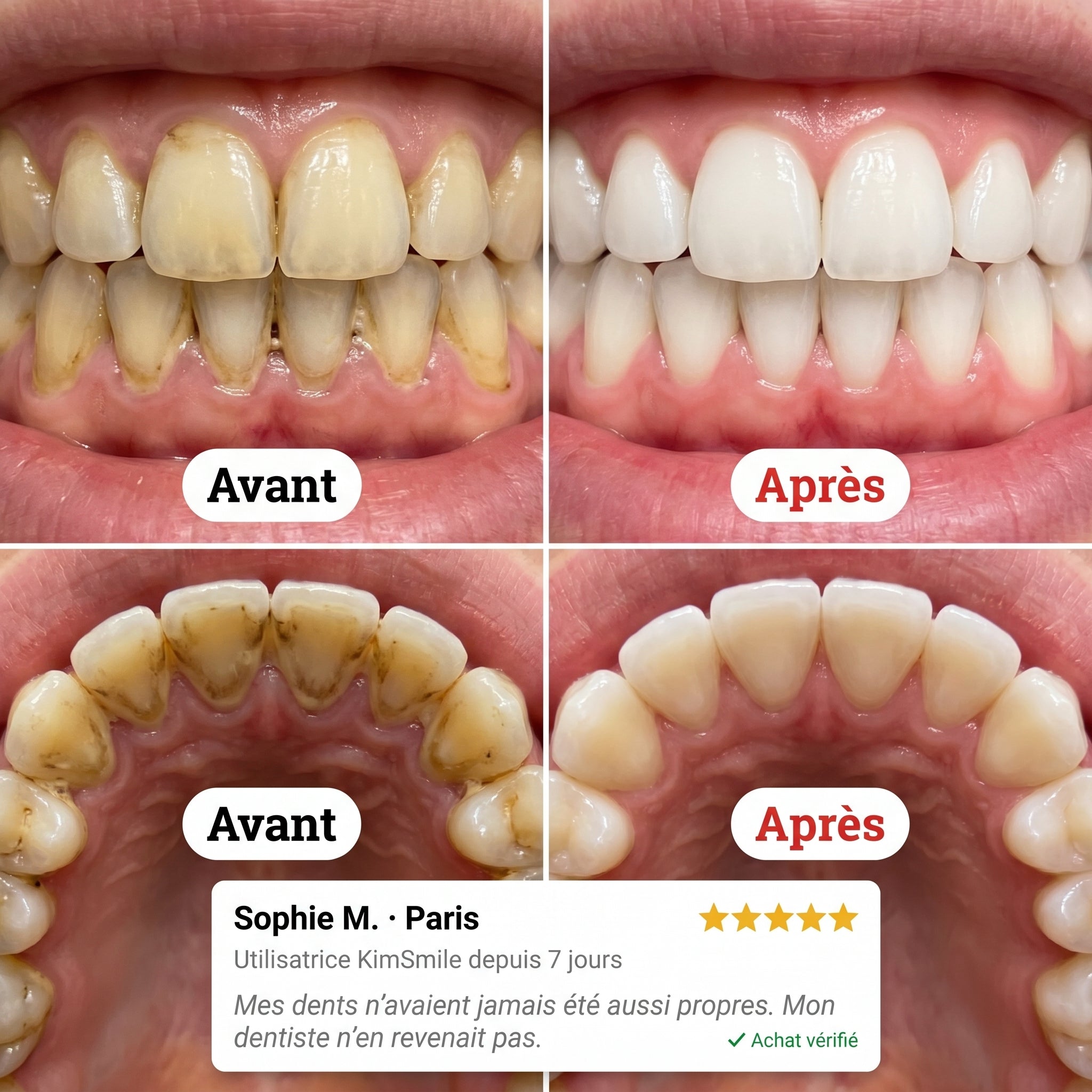 Ce que ta brosse à dents laisse chaque soir, KimSmile te le montre. Dès le 1er rinçage.