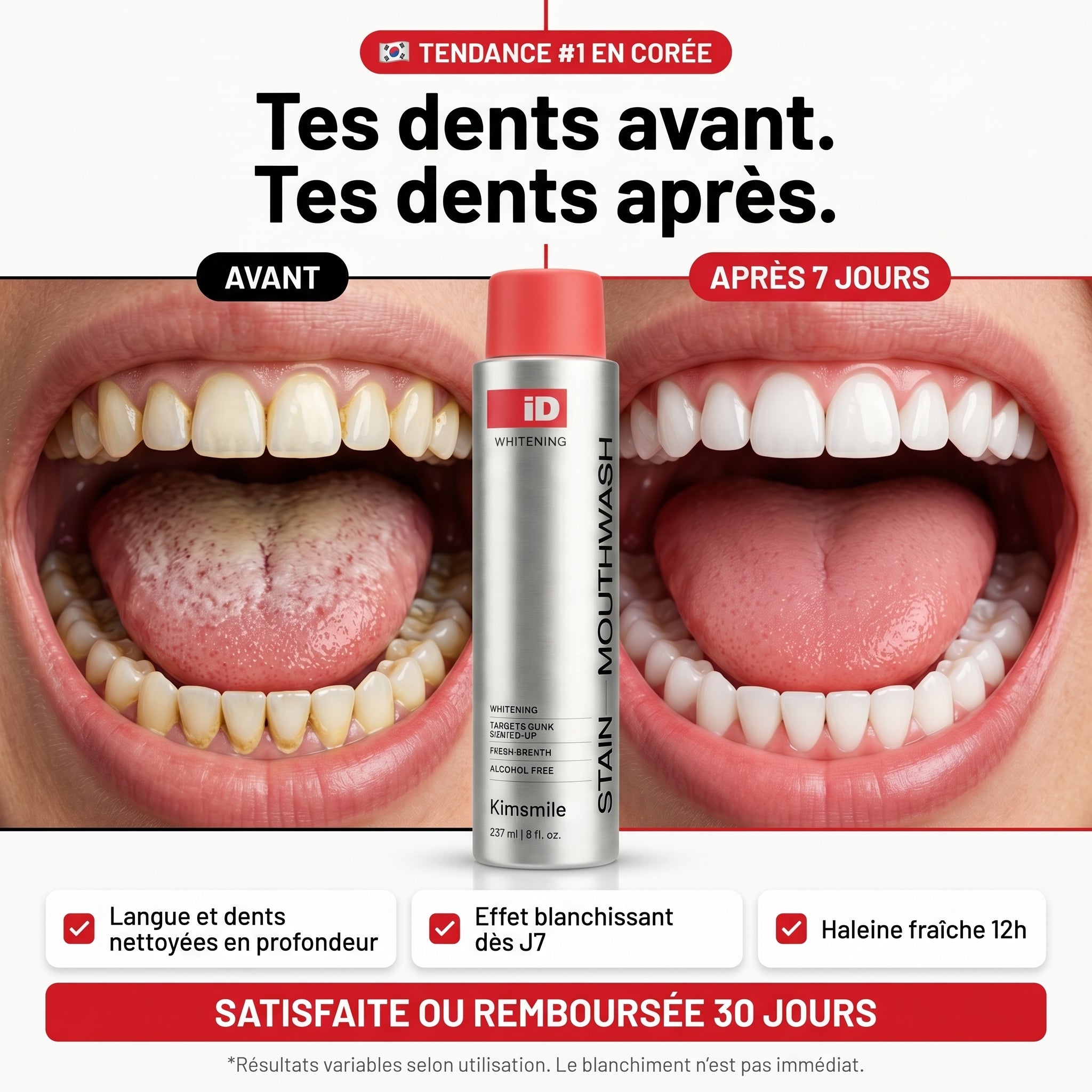 Bain de bouche blanchissant coréen iD KimSmile